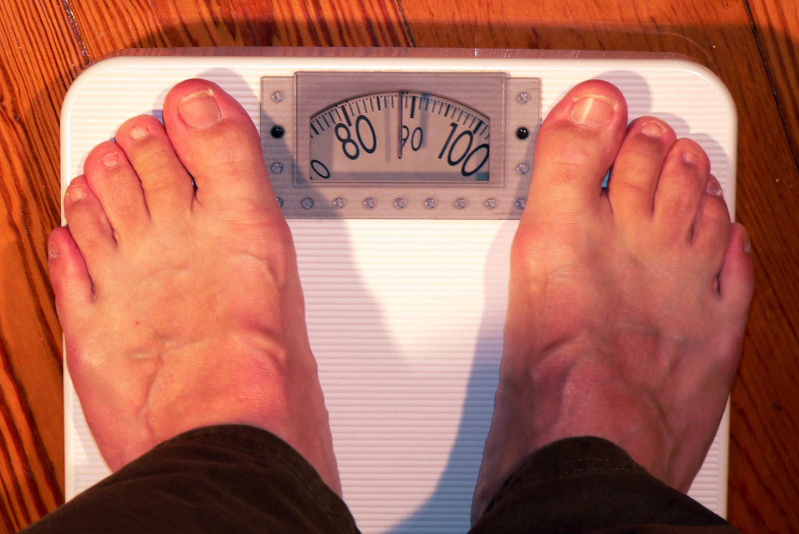 Leia mais sobre o artigo Dá pra tratar Varizes acima do peso?